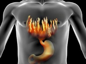 Você Está Procurando Por Alívio de Refluxo Gastroesofágico?