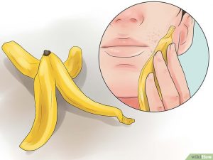 cravos e espinhas-casca de banana