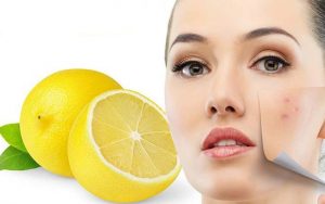 cravos e espinhas suco de limao