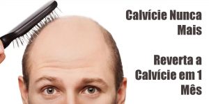 vencendo a calvicie