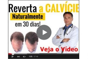 calvicie