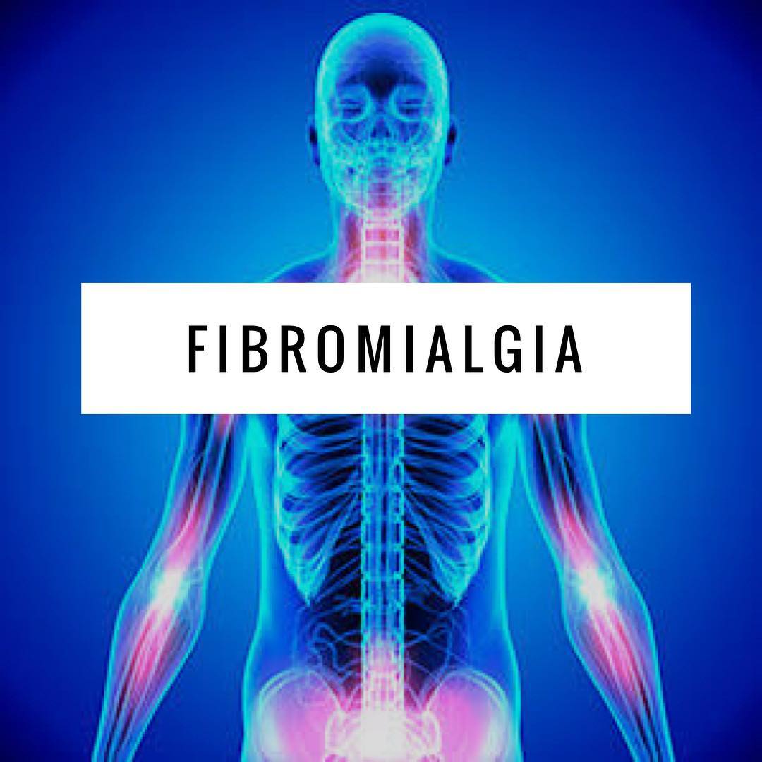 fibromialgia